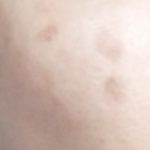 ケシミンで男性の顔に残るシミを効果的に消す方法