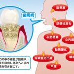 成人病予防の口内環境改善