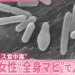 ボツリヌス食中毒