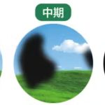 緑内障とか洒落にならない